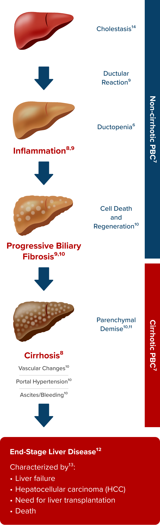 Diagram illustrating PBC disease progression